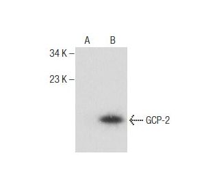 ENA-78 Antibody (D-6) - Western Blotting - Image 260772SAM Transcription Activation: SAM system utilizing dCas9-VP64, MS2-P65-HSF1, and sgRNA for precise gene transcription activation. 