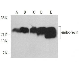 endobrevin Antibody (G-12) - Western Blotting - Image 359066 