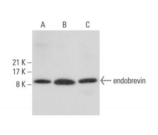 endobrevin Antibody (G-12) - Western Blotting - Image 308550