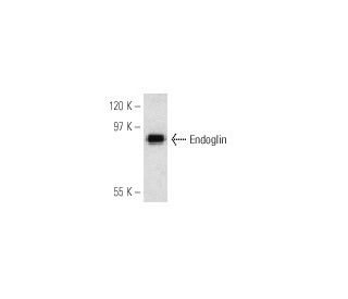 Endoglin/CD105 Antibody (P4A4) - Western Blotting - Image 6881Each CRISPR/Cas9 Knockout (KO) Plasmid product consists of a pool of 3 plasmids designed to ensure identification and cleavage of a specific gene for maximum knockout efficiency. Each plasmid encodes a unique 20 nt sequence derived from the GeCKO (v2) library.