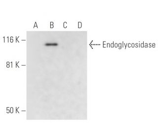 Endoglycosidase [EndoS] Antibody (B-8) - Western Blotting - Image 300503