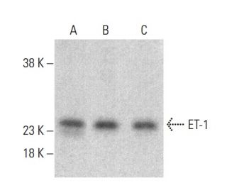 Endothelin-1/EDN1/ET-1 Antibody (C7) - Western Blotting - Image 399434The Double Nickase Plasmid features a U6 promoter for sgRNA expression, a 20 nt targeting sequence, and a gRNA scaffold to guide Cas9n. It includes a CBh promoter for Cas9n (D10A) and puromycin resistance, GFP for transfection verification, and nuclear localization signals (NLS). The 2A peptide allows co-expression of Cas9n and Puro from a single promoter, enabling precise genome editing with reduced off-target effects. 