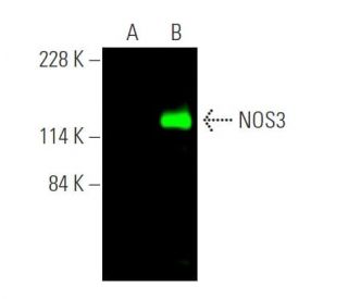 eNOS Antibody (A-9) - Western Blotting - Image 371796