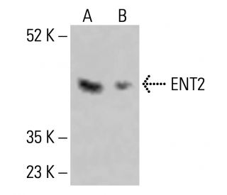 ENT2 Antibody (A-8) - Western Blotting - Image 414458