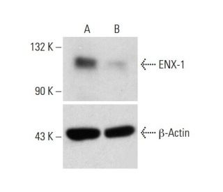 ENX-1 CRISPR/Cas9 KO Plasmid (h): sc-417028. Western blot analysis of... 