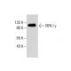 PIPK I γ Antibody (F-11) - Western Blotting - Image 285164 