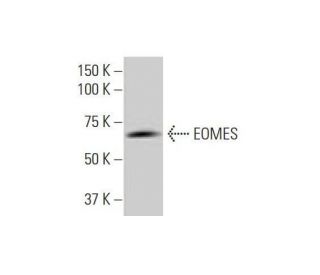 EOMES Antibody (1A8) - Western Blotting - Image 352164SAM Transcription Activation: SAM system utilizing dCas9-VP64, MS2-P65-HSF1, and sgRNA for precise gene transcription activation.