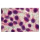 Eosin Y: sc-203734 and Hematoxylin: sc-24973. Staining of methanol fixed HeLa cells showing cytoplasmic (Pink-Eosin Y) and
