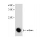 eotaxin Antibody (G-1) - Western Blotting - Image 149460