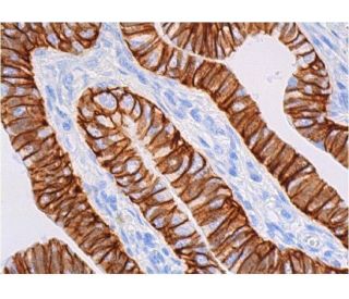 Ep-CAM Antibody (323/A3) - Immunohistochemistry - Image 355414 