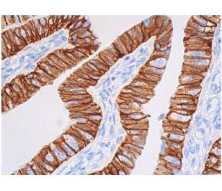 Ep-CAM Antibody (HEA125) - Immunohistochemistry - Image 355402 
