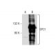 EPC1 Antibody (D-6) - Western Blotting - Image 160539