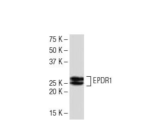 EPDR1 Antibody (S8F) - Western Blotting - Image 33472 