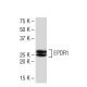 EPDR1 Antibody (S8F) - Western Blotting - Image 33472 