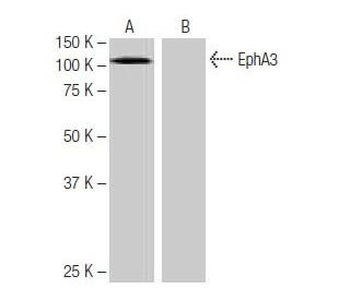 EphA3 Antibody (4-RE49) - Western Blotting - Image 64929