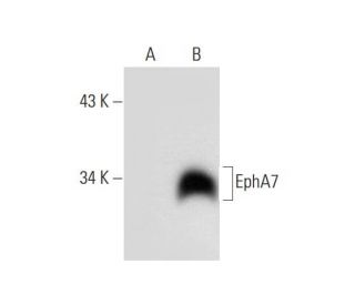 EphA7 Antibody (F-10) - Western Blotting - Image 299443