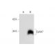 EphA7 Antibody (F-10) - Western Blotting - Image 299443