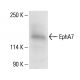 EphA7 Antibody (G-7) - Western Blotting - Image 411249 