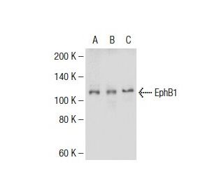 EphB1 Antibody (5F10A4) - Western Blotting - Image 137466The Double Nickase Plasmid features a U6 promoter for sgRNA expression, a 20 nt targeting sequence, and a gRNA scaffold to guide Cas9n. It includes a CBh promoter for Cas9n (D10A) and puromycin resistance, GFP for transfection verification, and nuclear localization signals (NLS). The 2A peptide allows co-expression of Cas9n and Puro from a single promoter, enabling precise genome editing with reduced off-target effects.