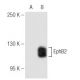 EphB2 Antibody (48CT12.6.4) - Western Blotting - Image 57272