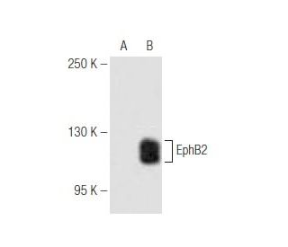 EphB2 Antibody (48CT12.6.4) - Western Blotting - Image 57272