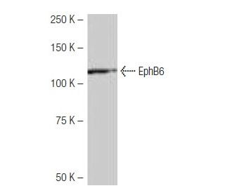 EphB6 Antibody (11D4) - Western Blotting - Image 64931