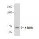 EphB6 Antibody (2A6B9) - Western Blotting - Image 137465