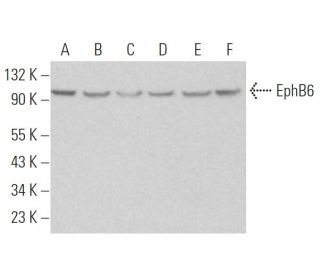 EphB6 Antibody (2A6B9) - Western Blotting - Image 374712 