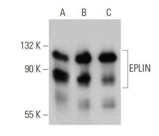 EPLIN Antibody (20) - Western Blotting - Image 359394 
