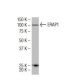 ERAP1 Antibody (731) - Western Blotting - Image 34100