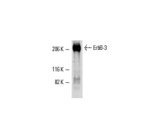 ErbB3/HER3 Antibody (RTJ.2) - Western Blotting - Image 2747 