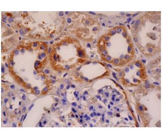 ErbB3/HER3 Antibody (SGP1) - Immunohistochemistry - Image 287318