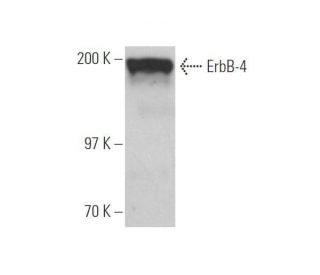 ErbB4/HER4 Antibody (2Q322) - Western Blotting - Image 353092 