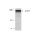ErbB4/HER4 Antibody (2Q322) - Western Blotting - Image 353092 