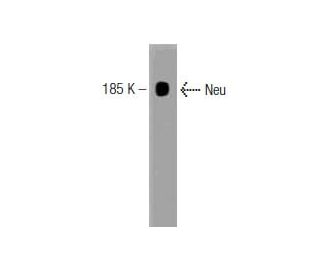ErbB2/HER2 Antibody (42) - Western Blotting - Image 127463