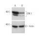 ERK 1 siRNA (m): sc-29308. Western blot analysis of ERK 1 expression in non-transfected control (A) and ERK 1 siRNA transf