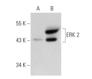 ERK 2 Antibody (6G11) - Western Blotting - Image 82386 
