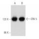 ERK 5 Antibody (C-11) - Western Blotting - Image 354696