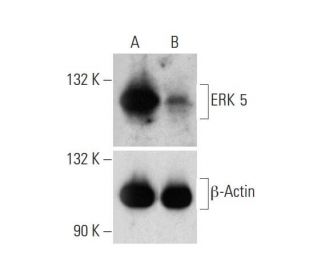 ERK 5 HDR Plasmid (h): sc-400891-HDR. Western blot analysis of ERK 5 expression in non-transfected control (A) and puromyc 