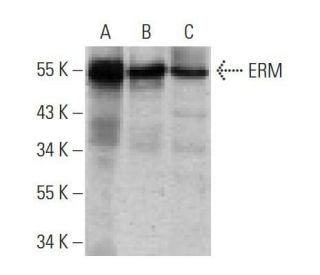 ERM Antibody (3H3) - Western Blotting - Image 358253