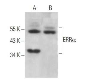 ERRα Antibody (2ERR2) - Western Blotting - Image 372369Each CRISPR/Cas9 Knockout (KO) Plasmid product consists of a pool of 3 plasmids designed to ensure identification and cleavage of a specific gene for maximum knockout efficiency. Each plasmid encodes a unique 20 nt sequence derived from the GeCKO (v2) library.