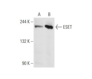 ESET Antibody (A-1) - Western Blotting - Image 66332The Double Nickase Plasmid features a U6 promoter for sgRNA expression, a 20 nt targeting sequence, and a gRNA scaffold to guide Cas9n. It includes a CBh promoter for Cas9n (D10A) and puromycin resistance, GFP for transfection verification, and nuclear localization signals (NLS). The 2A peptide allows co-expression of Cas9n and Puro from a single promoter, enabling precise genome editing with reduced off-target effects.