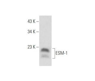 ESM-1 Antibody (C-10) - Western Blotting - Image 345907SAM Transcription Activation: SAM system utilizing dCas9-VP64, MS2-P65-HSF1, and sgRNA for precise gene transcription activation.
