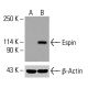 BRCAA1(C-8)抗体:sc-515650。通过蛋白质印迹分析未处理的HeLa(A)、化学处理的HeLa(B、C)和HCT-116(D)完整细胞裂解物中的BRCAA1表达 。β-肌动蛋白(C4):sc-47778用作加载对照。使用的检测试剂:m-IgG Fc BP-HRP:sc-525409。 Espin Antibody (E-1) - Western Blotting - Image 416048