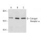 Estrogen Receptor alpha Antibody (AER314) - Western Blotting - Image 18127