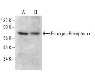 Estrogen Receptor alpha Antibody (D-12) - Western Blotting - Image 376606 