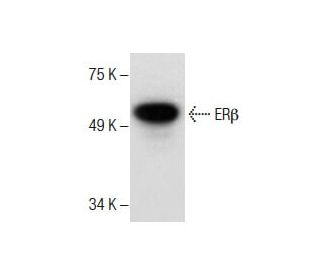 Estrogen Receptor beta Antibody (B-1) - Western Blotting - Image 287465Each CRISPR/Cas9 Knockout (KO) Plasmid product consists of a pool of 3 plasmids designed to ensure identification and cleavage of a specific gene for maximum knockout efficiency. Each plasmid encodes a unique 20 nt sequence derived from the GeCKO (v2) library. 