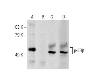Estrogen Receptor beta Antibody (1531) - Western Blotting - Image 147934Each CRISPR/Cas9 Knockout (KO) Plasmid product consists of a pool of 3 plasmids designed to ensure identification and cleavage of a specific gene for maximum knockout efficiency. Each plasmid encodes a unique 20 nt sequence derived from the GeCKO (v2) library.