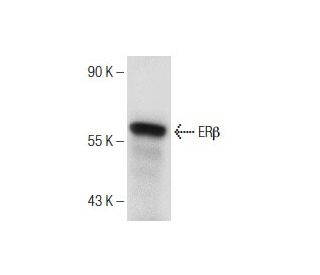 Estrogen Receptor beta Antibody (B-3) - Western Blotting - Image 150955The Double Nickase Plasmid features a U6 promoter for sgRNA expression, a 20 nt targeting sequence, and a gRNA scaffold to guide Cas9n. It includes a CBh promoter for Cas9n (D10A) and puromycin resistance, GFP for transfection verification, and nuclear localization signals (NLS). The 2A peptide allows co-expression of Cas9n and Puro from a single promoter, enabling precise genome editing with reduced off-target effects. 