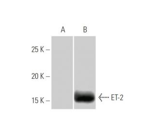 Endothelin-2/EDN2/ET-2 Antibody (3B4-1C5) - Western Blotting - Image 347548 